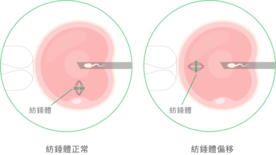 茂盛透過專業胚胎師的精準判讀 實踐真正的精準醫療