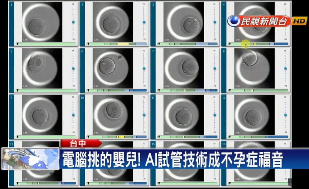 茂盛醫院AI選胚胎技術造福不孕症患者 (1)