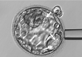 vacuoles(+)