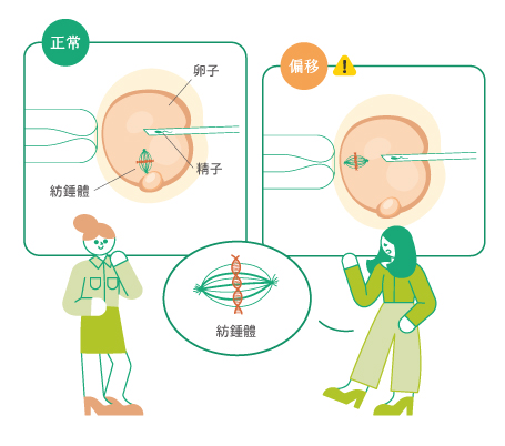 圖解卵子紡錘體定位技術