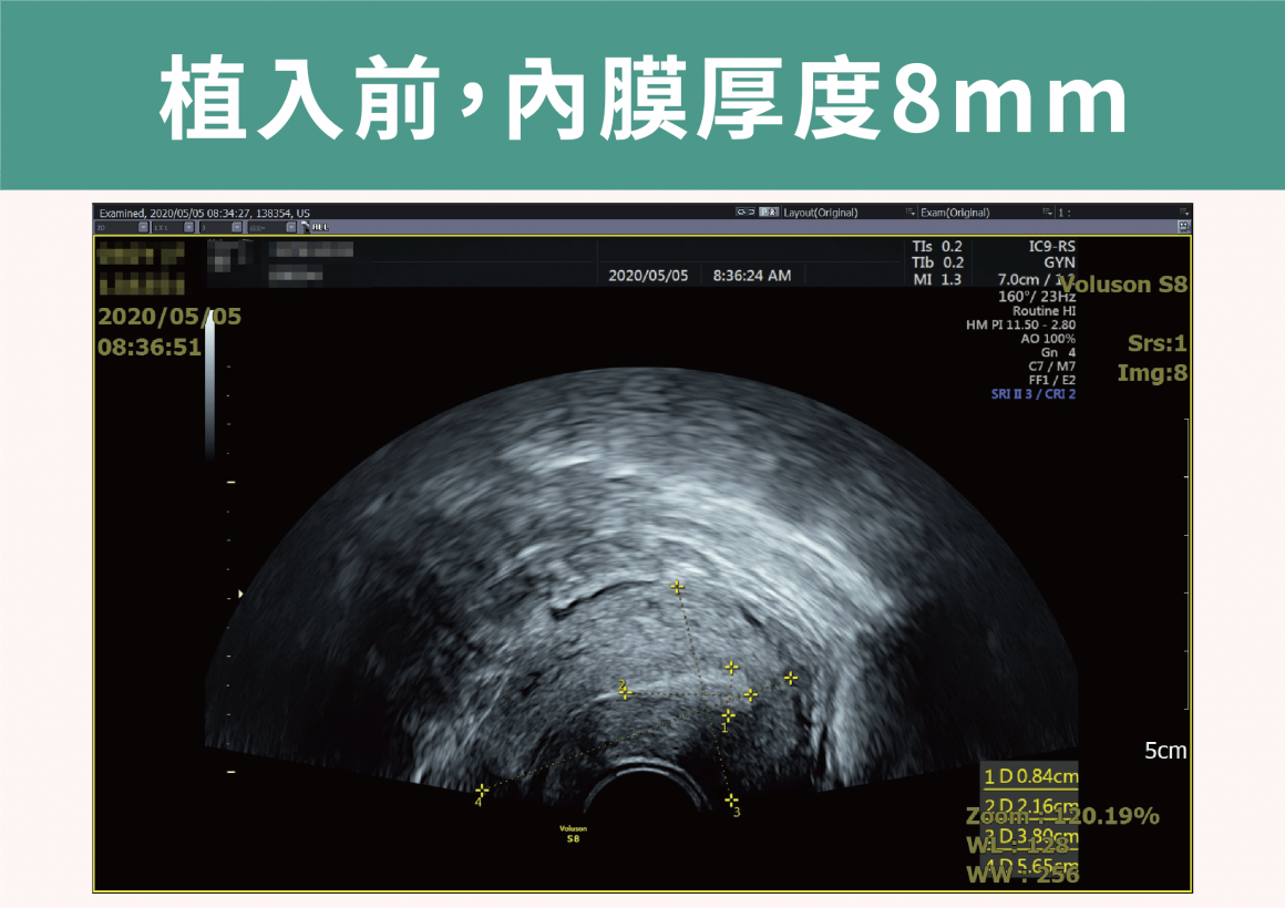 tw_news_list_22j11_zg3fiki89n-min tw_news_list_22j11_zg3fiki89n-min