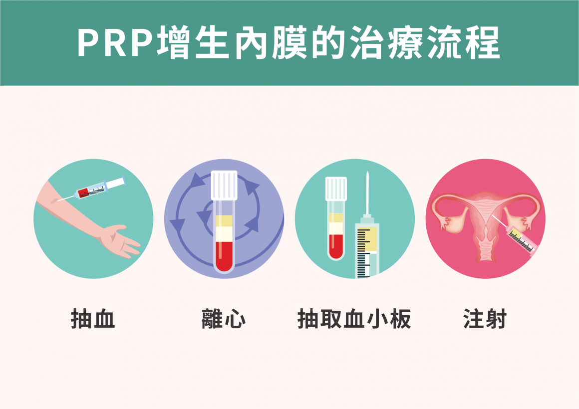 PRP療法治療流程 PRP療法治療流程