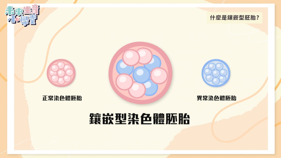 鑲嵌型染色體胚胎