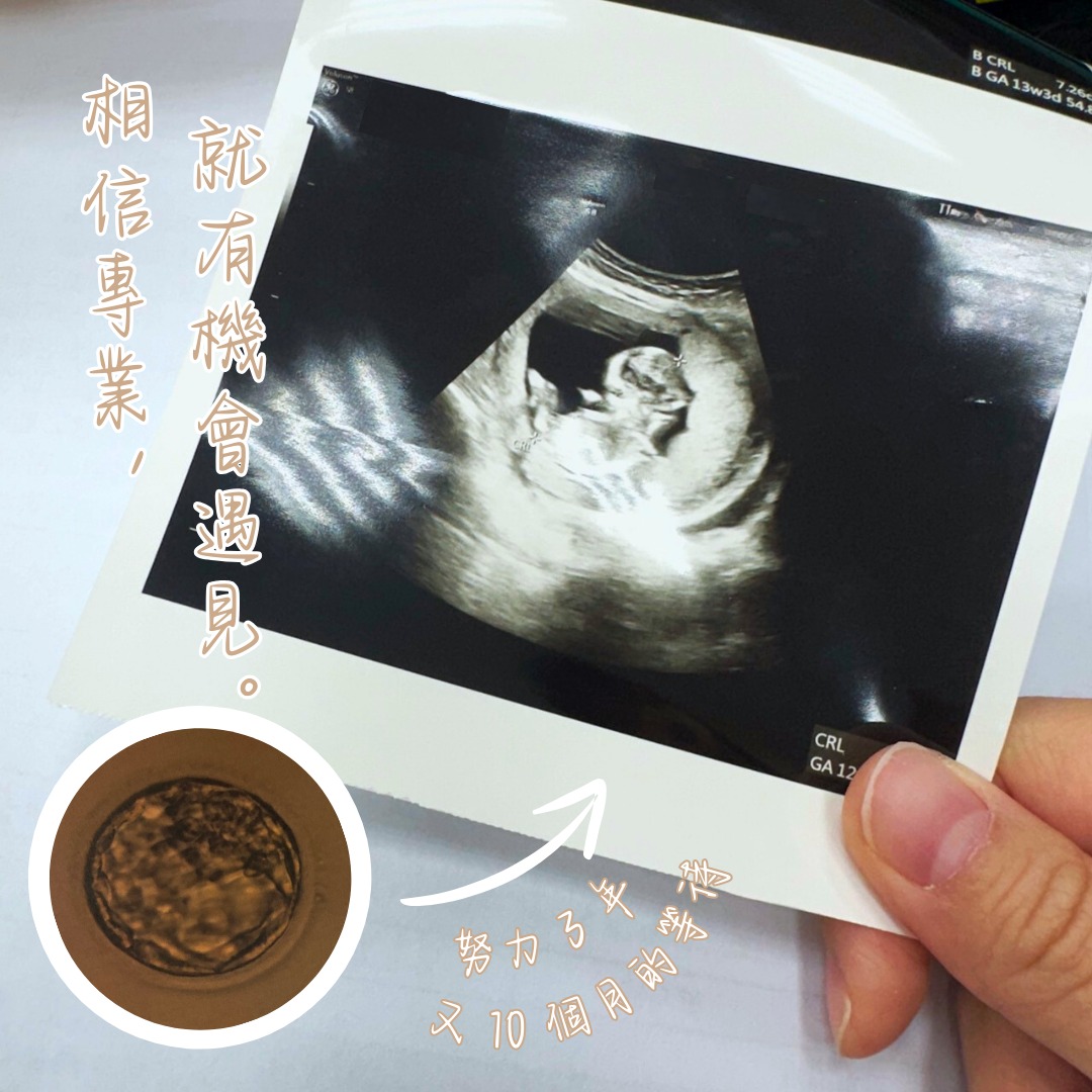 我始終相信院長一定會讓我擁有寶貝