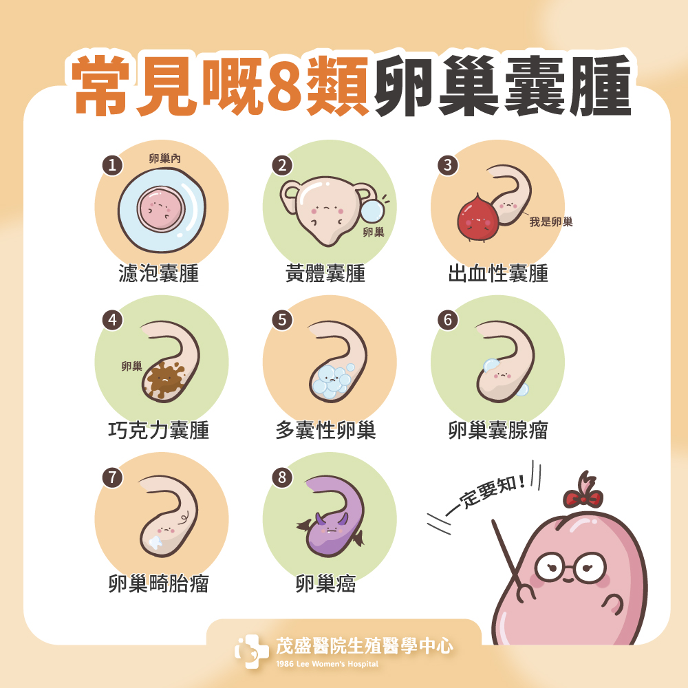 常見嘅8類卵巢囊腫 一定要知！