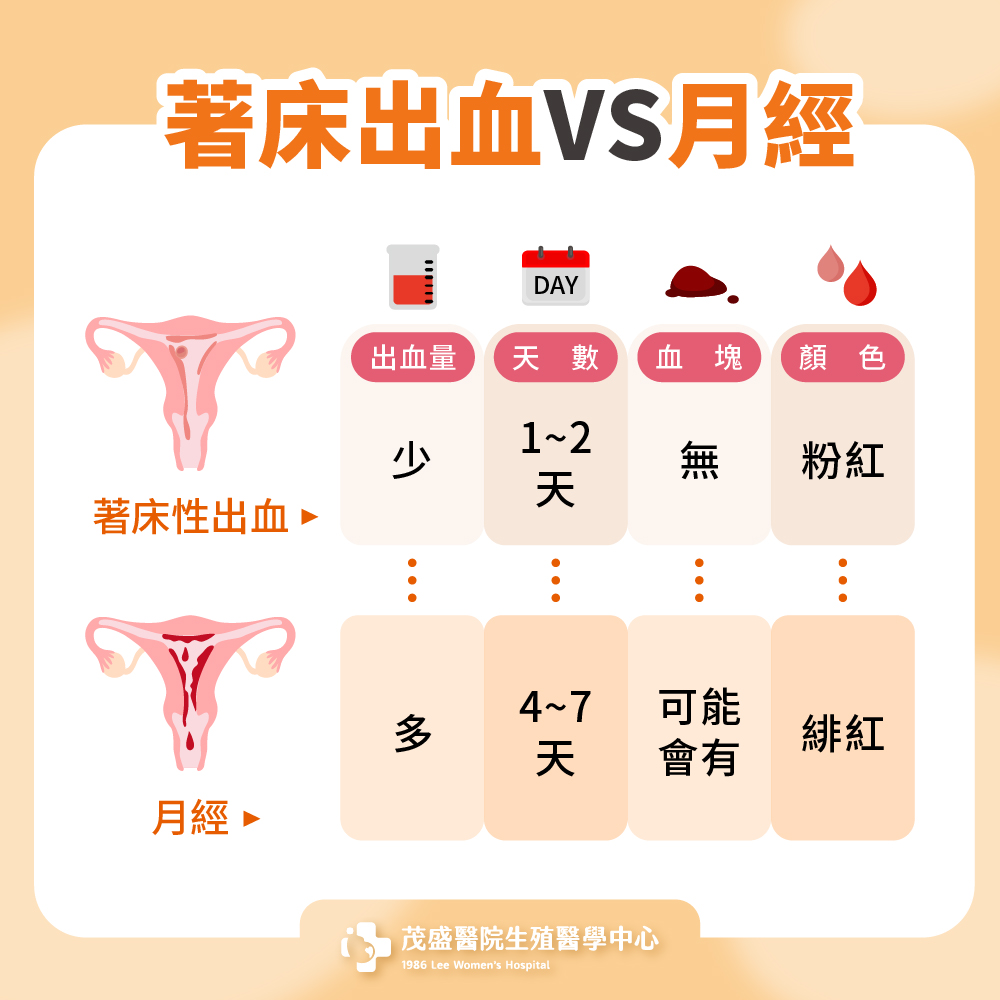 著床出血與月經的差異