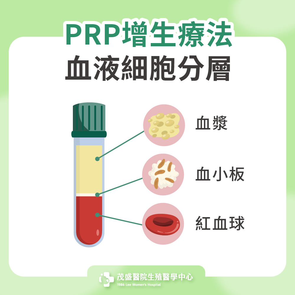 PRP增生療法血液細胞分層